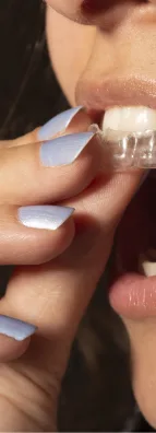 Dental care alignment