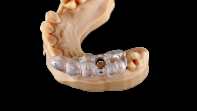 Curso de Odontología Digital – Cirugía Guiada & Impresión 3D